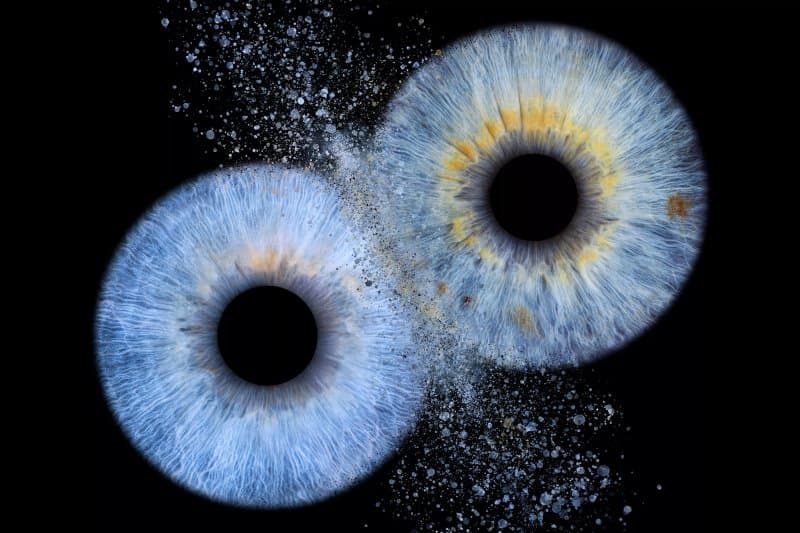 Art Of Eye Gallery- Iris Photo