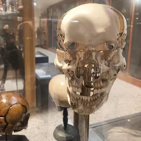 Museo di Anatomia Umana “Filippo Civinini”