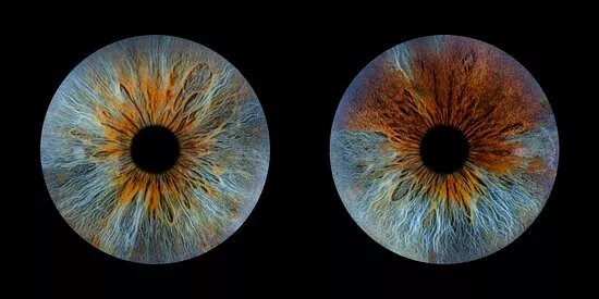 IRIS GALERIE NANTES
