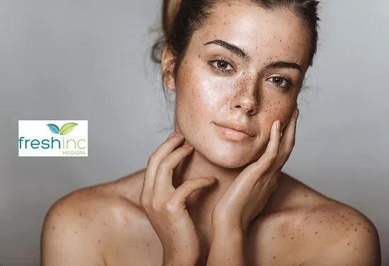 Fresh inc medispa (St Andrews)